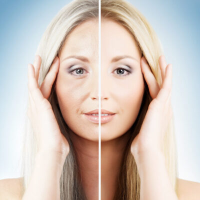 Half old and half young woman’s portrait. Botox concept.